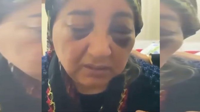 Körfezde Kadına şiddet bardağı taşıran son damla oldu