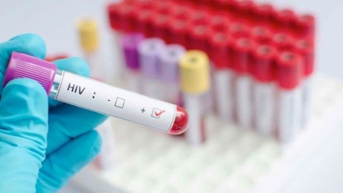 KOÜ Tıp Fakültesi Öğretim Üyesi Prof. Dr. Sıla Akhan; “Polikliniğe her hafta 1-2 yeni HIV vakası geliyor” KOÜ Tıp Fakültesi Öğretim Üyesi Prof. Dr. Sıla Akhan; “Polikliniğe her hafta 1-2 yeni HIV vakası geliyor”